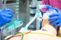 Open 06 Notfallmanagement und Reanimation